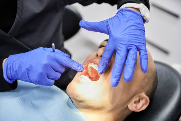 Best Emergency Dental Extractions in Troy, TX